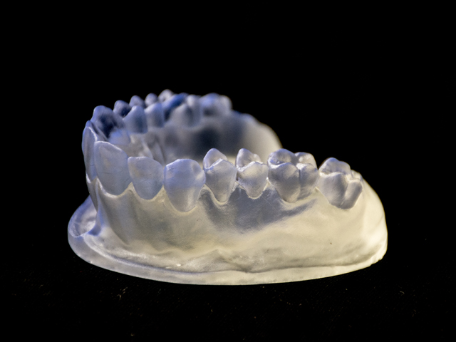 Dental model print, high-detail resin